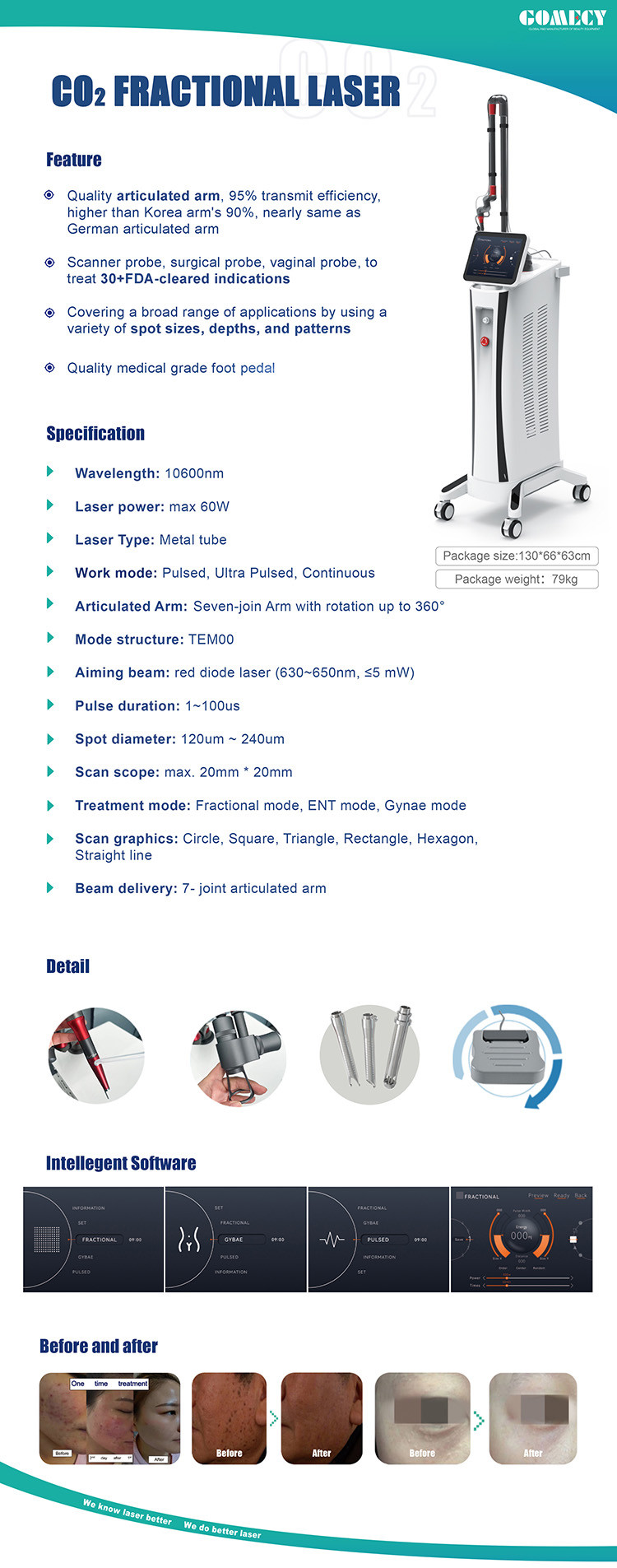 60W Fractional Treatment Co2 Laser Skin Rejuvenation Machine 10600nm