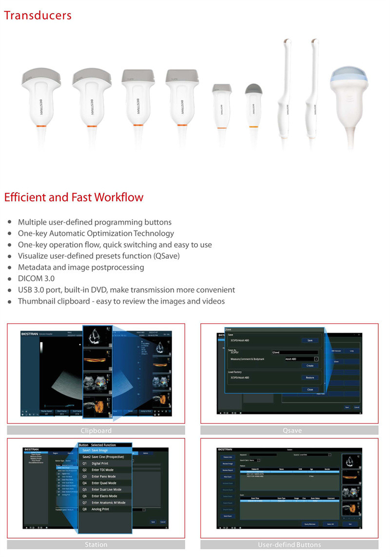 Portable 4D Ultrasound Machine Medical Data Interface Video VGA DICOM3.0 USB Printer Port