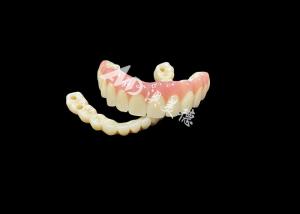 Wholesale Implant supported dentures Bridge The Ultimate Dental Solution For Missing Teeth from china suppliers