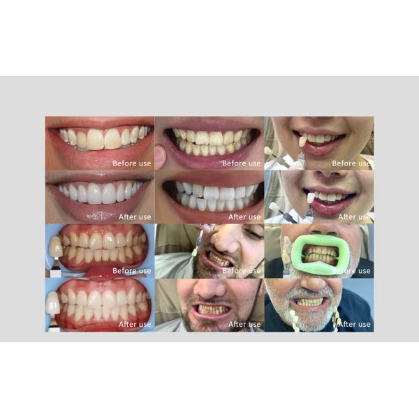 Herbal Extract Gel Teeth Whitening Pen Professional Daily Instant whitening Pen For Daily Home Using Other Whitening Products