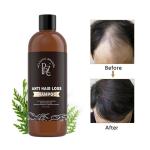 Argan Oil Anti Dandruff Anti Hair Loss Shampoo And Conditioner Customized