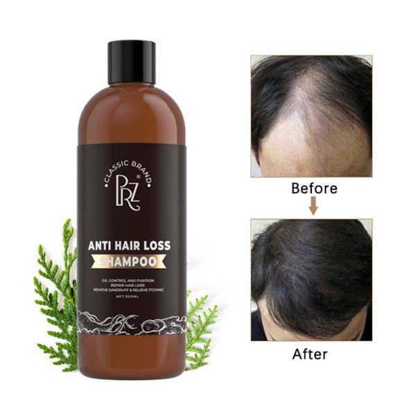 Argan Oil Anti Dandruff Anti Hair Loss Shampoo And Conditioner Customized