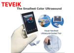 Medical Wifi Ultrasound Machine Android Portable Wireless Ultrasound Probe