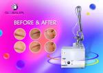 Facial Skin Resurfacing Treatment RF CO2 Fractional Laser Machine For Beauty