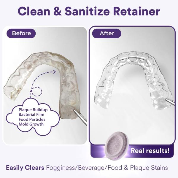 Retainer Cleaner Tablets Invisalign Cleaner Remove Stains 30 Count Grape Scented