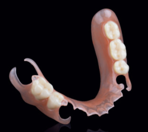 Valplast Flexible Partial Removable Dentures Precision Attachment In Prosthodontics