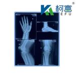 Factory Medical X Ray Film Blue Sensitive Medical Xray Film