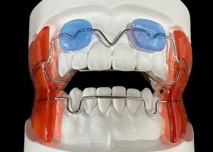 Wholesale Frankel 2/3 Orthodontic Appliance, enhancing Jaw Alignment in Growing Children from china suppliers