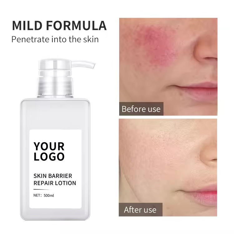 Glycyrrhiza Glabra Face Lotion Anti Acne Barrier Repair Lotion Soothing Sensitive