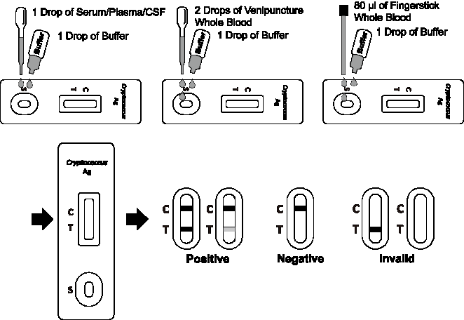 Cryptococcus Antigen Rapid Test Cassette CSF Cerebral Spinal Fluid Test Kit