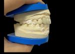 Unbeatable Strength Dental Zirconia Dentla Crown For Natural Looking Smiles