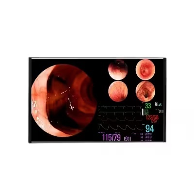 10.36 Inch Touch Screen Module 1200x2000 10 Point Touch Display With MIPI Interface