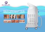 High Power Commercial Laser Hair Removal Machine 808nm / 755nm / 1064nm