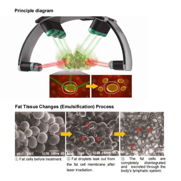 All In One 10D Slimming Roller Laser Equipment With Biolight Technology For Clinics And Spas