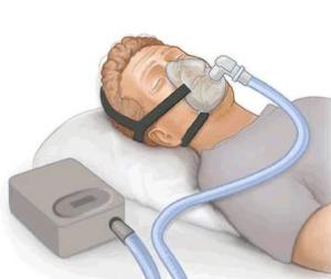 Wholesale Portable Medical Ventilator Machine 00-240 V For Icu Breathing Apparatus from china suppliers