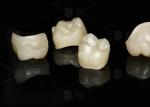 Natural Full Contour Zirconia Crown Precise Fit Full Contour Dental Lab