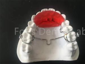 Wholesale Durable Orthodontic Retainer Expander Comfortable And Convenient Wear from china suppliers