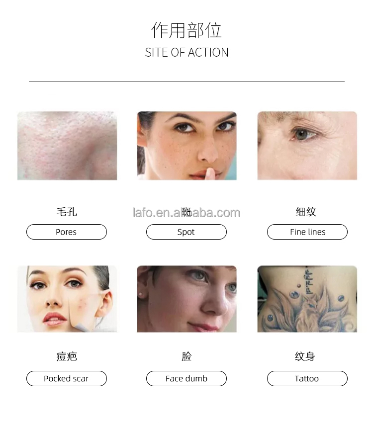 Salon Use 808nm Diode Laser Hair Removal Laser Body Hair Remover Professional