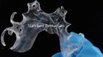 Clear framework Acrylic Metal Partial Denture Frameworks High Esthetics China