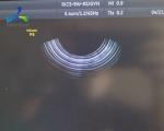 Gynaecology Ultrasound Probe Repair GE RIC5-9W-RS 4D Monitor Strain Relief