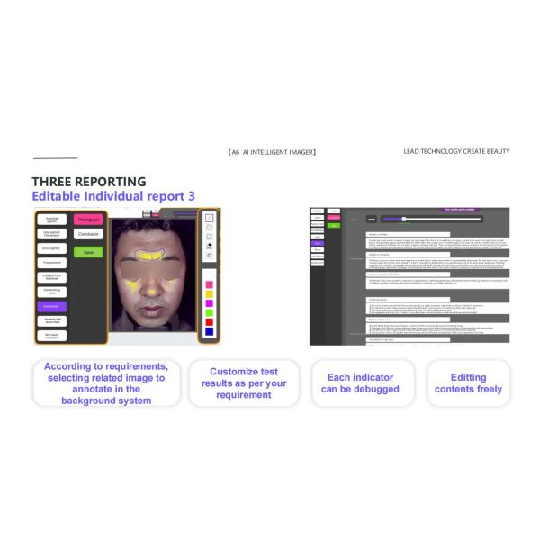 GMS- A6 Al Intelligent Face Analyzer Machine 15 Skin Problems Analysis Made Easy with 8 Spectral Imaging Technologies