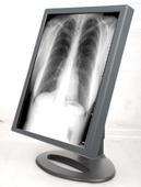 Wholesale Fast Transmission Grade Displays , Medical Grade Displays G51SP from china suppliers