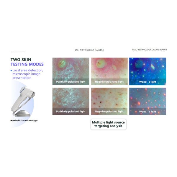 GMS- A6 Al Intelligent Face Analyzer Machine 15 Skin Problems Analysis Made Easy with 8 Spectral Imaging Technologies