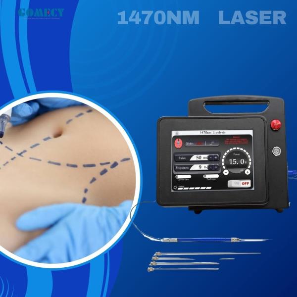 Professional Laser Lipo Machine Lipolysis Endolaser 980nm 1470nm Endo Face