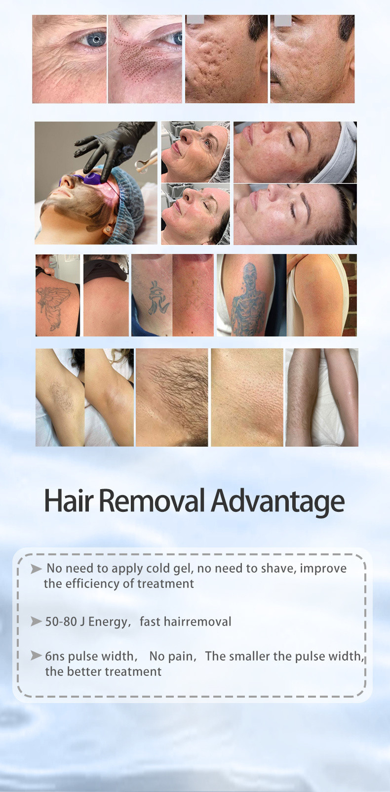 Enhance Beauty Routine Multi Purpose Beauty Appliance Diode Laser Technology 2 Handles