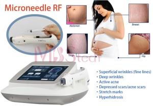Wholesale Stretch Marks Removal Face Lifting Rf Microneedle Machine from china suppliers