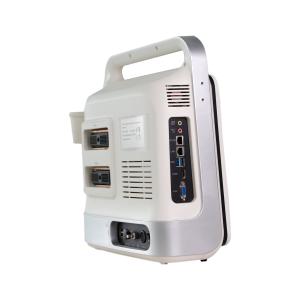 Wholesale CE 3D Doppler Ultrasound Scanner Windows 7 11KG from china suppliers