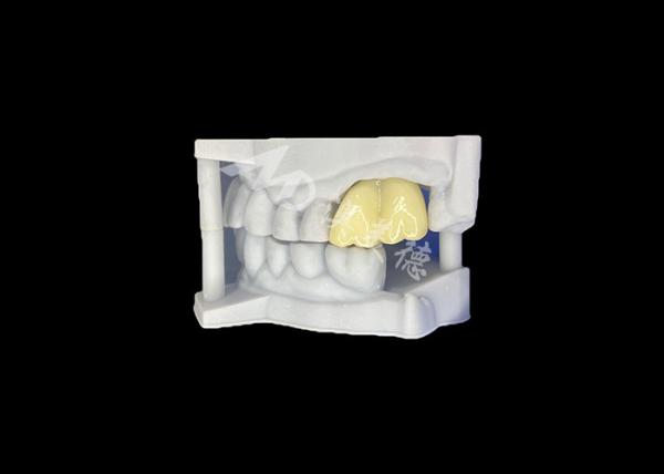 Solid Zirconia Dental Crown Long-lasting Durability Guaranteed Molar From China
