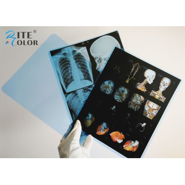 Medical Blue Sensitive X Ray Film PET Material For Image Inkjet Printing