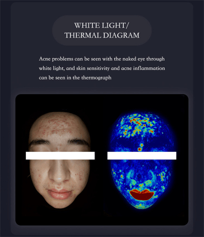 3d Skin Analyzer Device / Skin Tester Artificial Intelligence 8 In 1