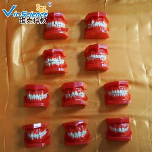 Wholesale VIC-E8 Ortho Dental Study Models Malocclusions Classification 10 Pieces from china suppliers