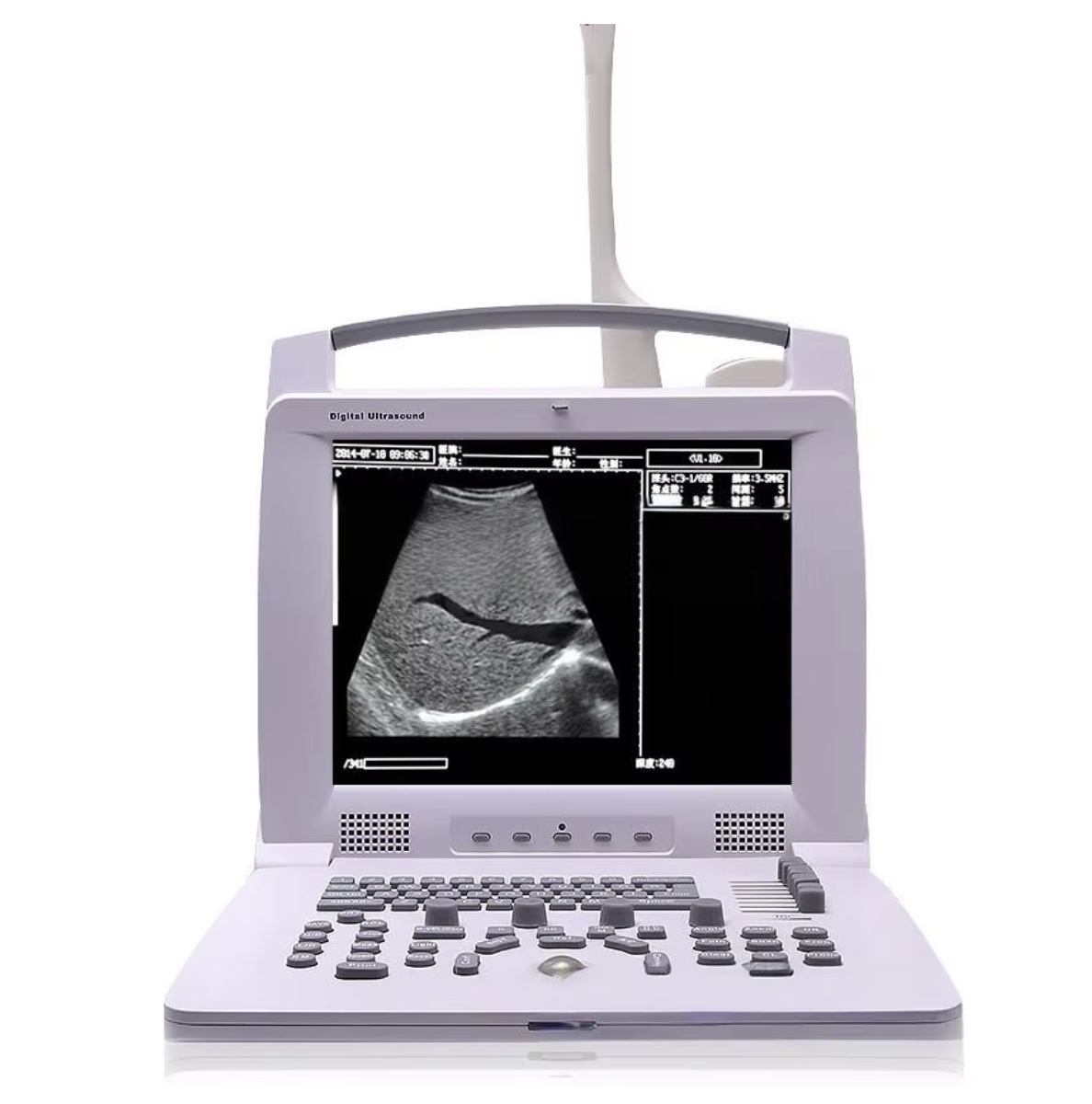 Lightweight Veterinary Portable Goat Ultrasound Scanner 12in Monitor 6KG