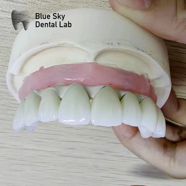 Full Arch Dental Implant Cases Compatible With Multiple Implant Systems