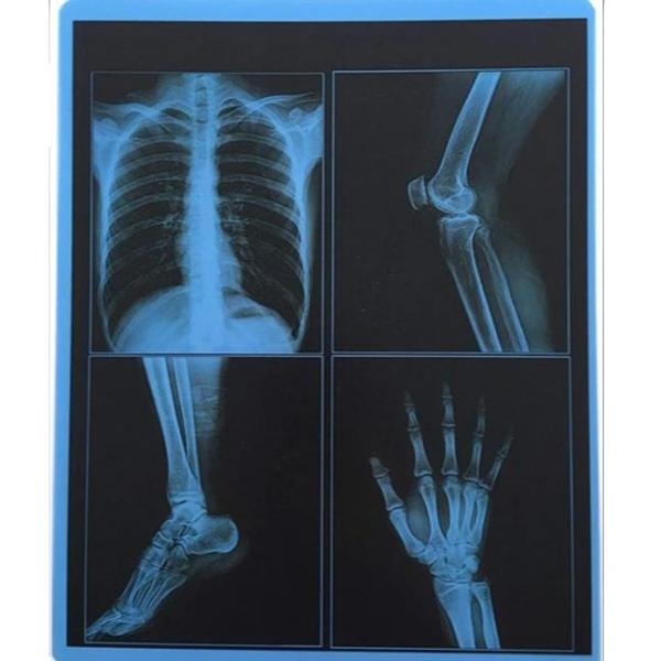 25cm X 30cm Blue Transparency PET Thermal Film Medical Dry Imaging Film For