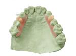 Flexible Denture Base Resin For Partially Edentulous Restoration Stable And