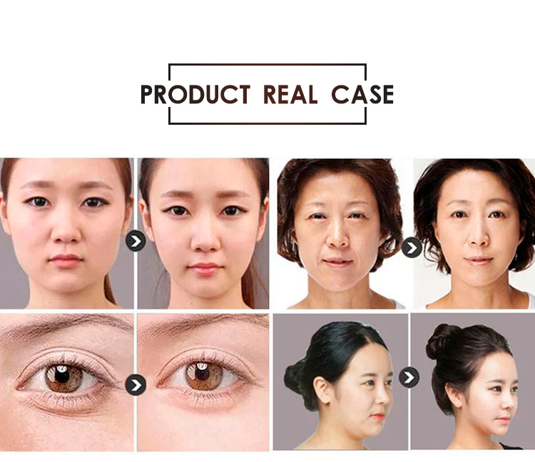 DS39 Personal Care 4D HIFU Beauty Machine Face Lifting Anti Aging