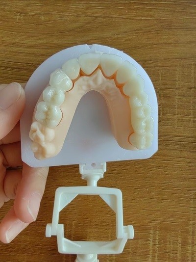Corrosion Resistant Zirconia Crowns Natural Looking Zirconia Teeth