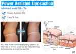 80kg 300W Input Surgical Liposuction Machine For Body Slimming Fat Freezing