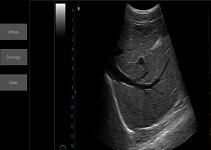 Ultrasound Scan Equipment Portable Ultrasound Scanner Palm Ipad Ultrasound Machine