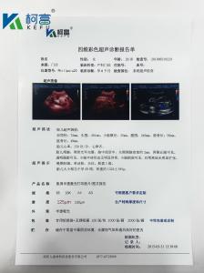 Wholesale Inkjet Transparent Medical Dry Film White X-Ray Film For CT DR MRI Radiological Device from china suppliers