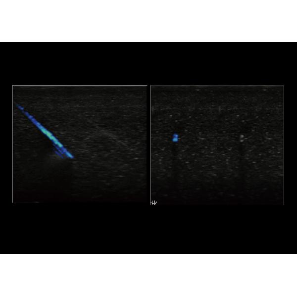 Cart-Based Chison Ultrasound Machine Xbit 90 With Auto EF Function