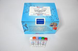 China Lyophilized IVD ANVISA Fluorescence PCR Detection Kit 40T/box on sale