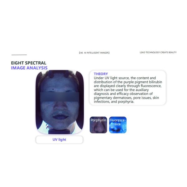 GMS- A6 Al Intelligent Face Analyzer Machine 15 Skin Problems Analysis Made Easy with 8 Spectral Imaging Technologies