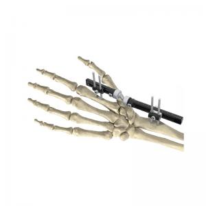 China Extra Articular Wrist External Fixator Cross Joint Wrist Ex Fix on sale