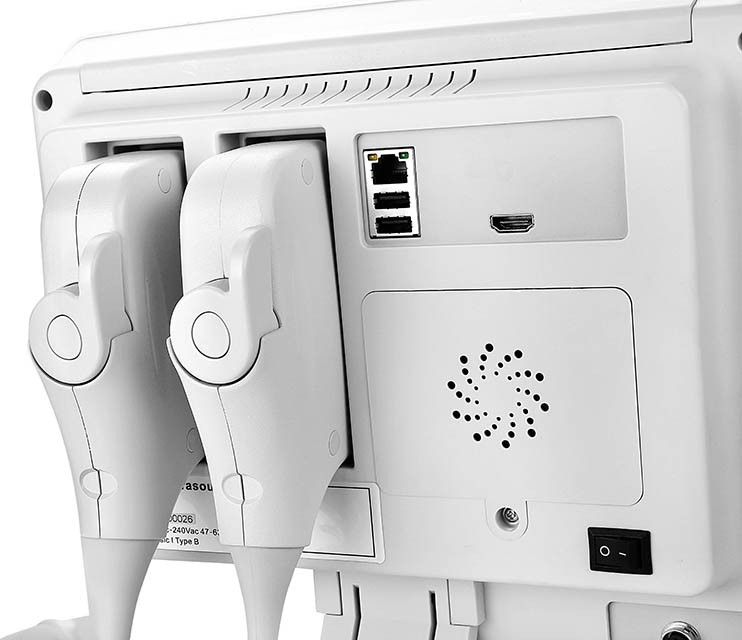 Notebook Type Color Doppler Ultrasound Scanner Usg For Human / Veterinary