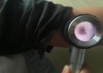 Customized Health Care Digital Video Otoscope Handheld Medical Dermatoscope For
